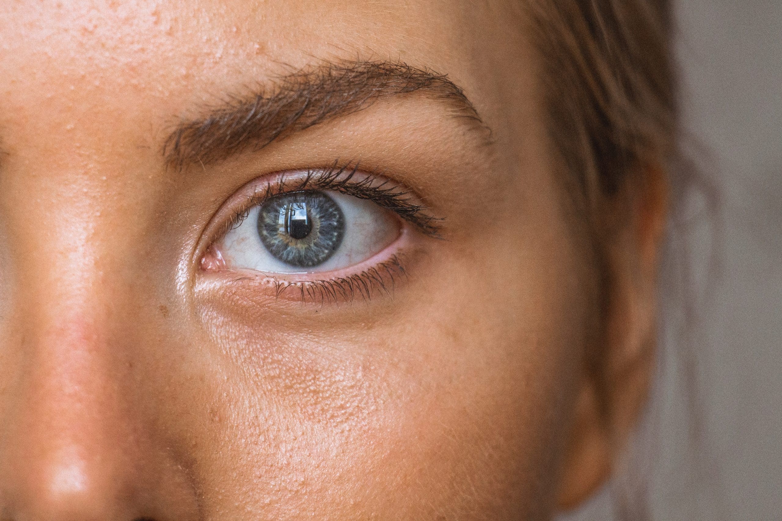 Let’s Talk Skin Goals: Acne Care